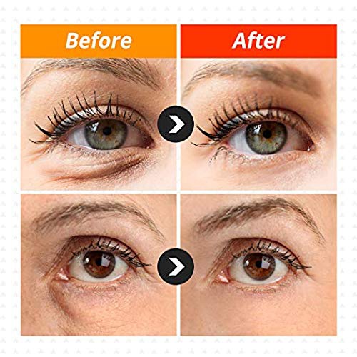  [Bellalussi]Ultra Repair Snail Eye Cream for Eye and Facial Reduce Dark Circle/Crow Feet & Anti-wrinkle with Snail/Herb