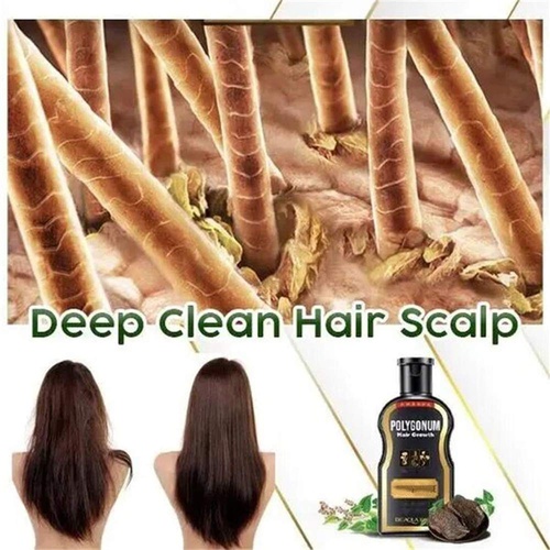  DTDR Natural Darkening Shampoo and Conditioner Organic Hair Darkening Shampoo Bar - Volumizing & Moisturizing - Black Hair Shampoo Hair Dye for Women Men Grey Hair (200ML)