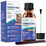 Dr. Luke Finger Nail And Toe Nail Fungus Treatment Extra Strength, Fungal Nail Renewal, Fungus Nail Treatment, Fungi Nail Repair For Nail antifungal