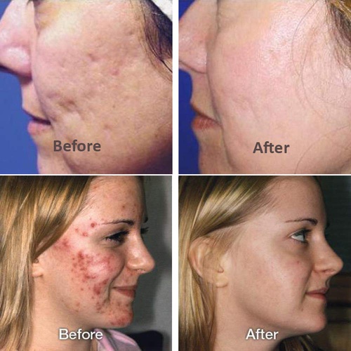  Dragon Honor Hyaluronic Acid Serum for Face Skin Repair Essence 2pcs