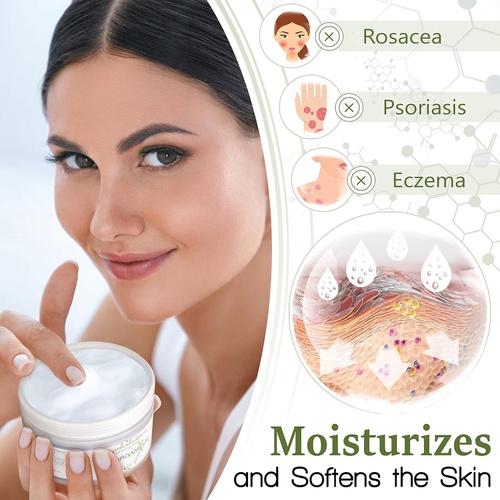  Epic Organicum Organic Aloe Vera Moisturizing Cream Body and Face Moisturizer For Acne, Psoriasis, Rosacea, Eczema, Aging, Itchy Dry or Sensitive Skin Care Cream, Skin Care Face Natural Cream (8
