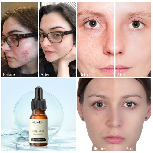  FGHJ 3PCS Zero Pore Instant Perfection Face Serum, Poreless Skin Tightening Anti Aging Serum, Pore Skin Care Serum Essential Oil, Facial Essence to Improve Enlarged Pores - for All Skin