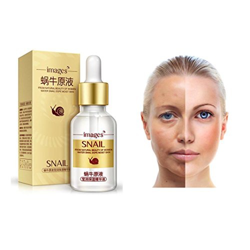  Snail Concentrate Moisturizing Essence,Fheaven Face Lifting Serum Cream Essence Skin Care Anti Aging Eternal Hyaluronic Acid