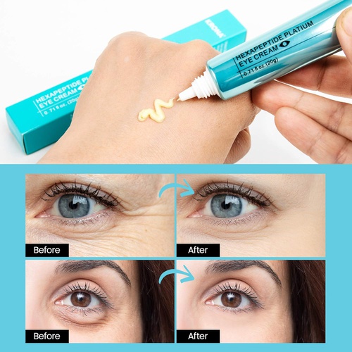  IBaste Hydrating Eye Cream - Rapid Wrinkle Repair Anti-Wrinkle Retinol Under Eye Cream for Dark Circles & Under Eye Bags - Safe & Organic Skin Care - Wrinkle Eye Cream With Hyaluronic Aci