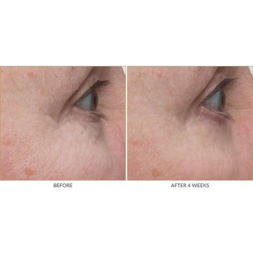  Kate Somerville +Retinol Firming Eye Cream - Eye Wrinkle Cream - Retinol Eye Cream (0.5 Fl. Oz)
