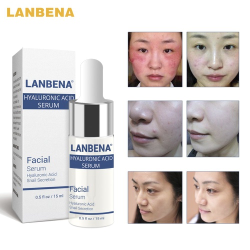  LANBENA Lady Face Serum Hyaluronic Acid Snail Anti Aging Moisturizing Essence for Repair Skin Damage Lifting and Firming and Replenishing Moisturizing - 15ml