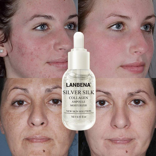  LANBENA Face Skin Silver Silk Collagen Ampoule Serum for Tightening Pores+Repairing Wrinkle Fine Lines+Moisturizing Nourishing+Anti-Aging and Anti-Oxidation (Silver)
