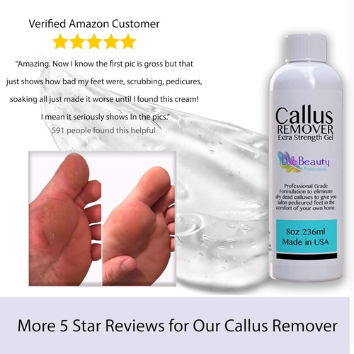  Lee Beauty Professional 8oz Callus Remover Gel and Foot File/Foot Rasp Spa Kit. Professional Foot Care for dry, cracked heels. Soak in foot spa then apply callus gel to feet, and use foot scraper to peel