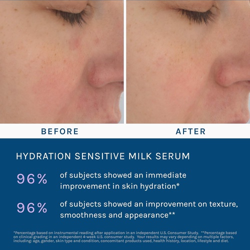  Milk Facial Serum for Sensitive Skin | H2O+ Japanese Skin Care | Luxury Clean Beauty | Sensitive Collection