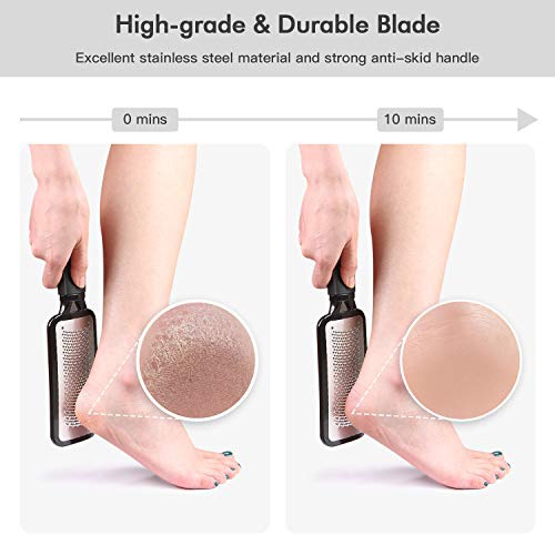  NIUTA 【Factory Direct】 Colossal Foot Rasp Foot Scrubber And Callus Remover，Surgical Grade Stainless Steel Foot File,Can Be Used On Trimming Dead Skin, Callus ect.