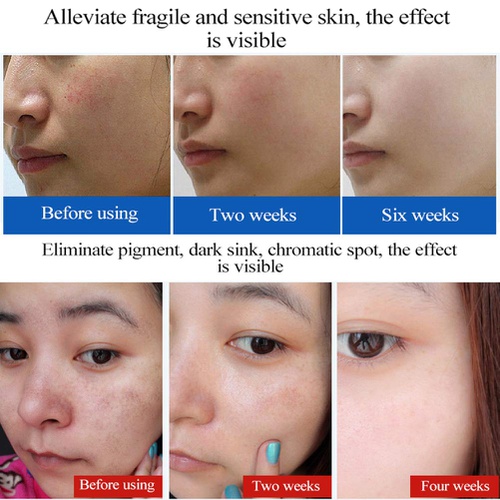  Ofanyia Moisturizing Aloe Vera Essence Firming Skin Face Serum