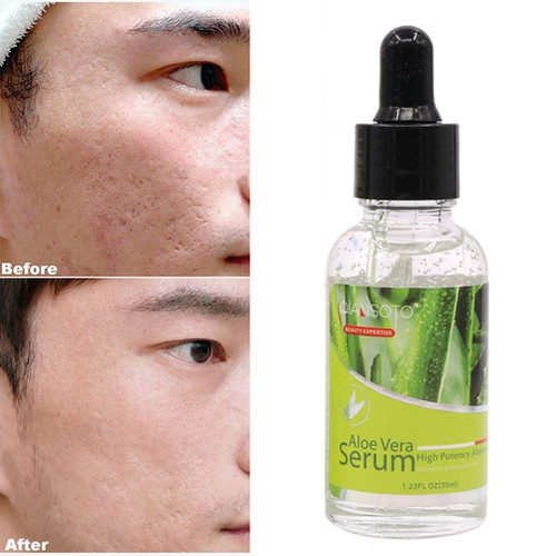  Ofanyia Moisturizing Aloe Vera Essence Firming Skin Face Serum