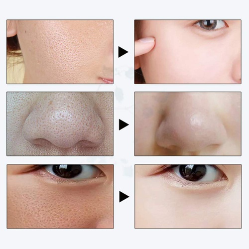  Pretty Comy Hyaluronic Acid Fine Pore Face Essence 0.34fl.oz - Shrink Pores Delicate Skin