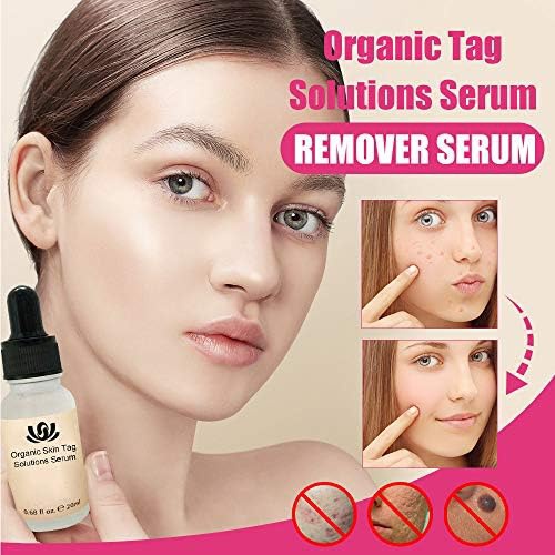  Promisen Organic Tags Solutions Serum, Skin Tag Remover, Acne Essence- Remove Moles and Skin Flaws, Anti Aging Anti-Wrinkle Serum Vitamin C Face Serum (20ml)