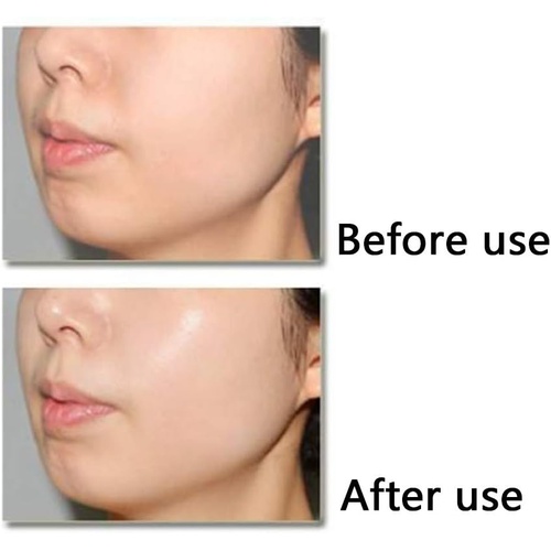  Pstars 7PCs Dark Spot Corrector Facial Essence for Face - Dark Spots Corrective Ampoule - Moisturizing Firming Facial Serum 2ML/0.07 fl oz. - Personal Skin Care