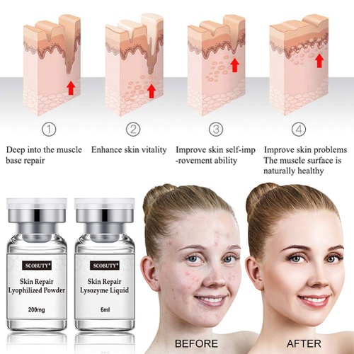  SCOBUTY Facial Serum, Acne Scar Treatment, Face Essence, Scar Fade Serum, Moisturizing Serum, Acne Treatment Serum, Moisturizing and Hydrating, Anti-Wrinkle,Anti-Aging,Firm and Lift Skin,R