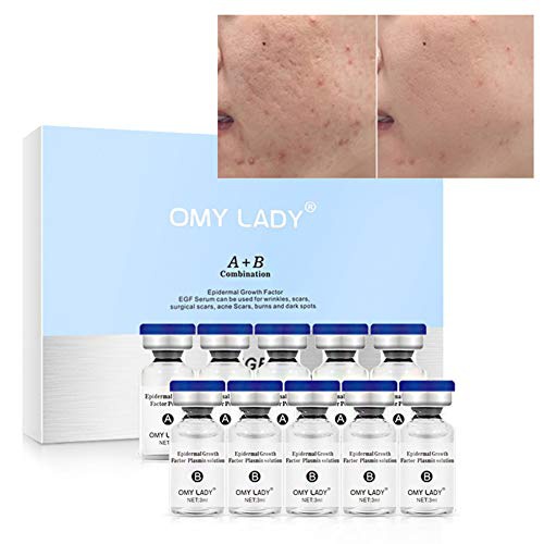  Anti-Pimple Essence, SUNSENT Rejuvenation Serum For Face Dermal Scar Acne Repair Freckle Blemish Anti-wrinkle Skin Care (5 Pairs)