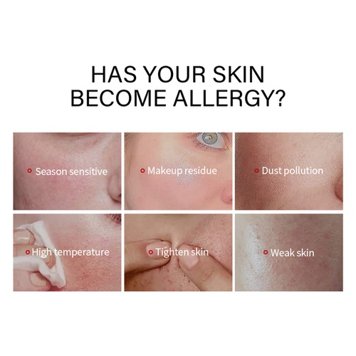  Seewe Face Anti-allergic Serum Skin Moisturizing Care Essence for Smoothen Skin Anti-redness Anti-inflammatory Strengthen Skin Elasticity