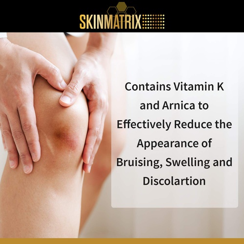  SkinMatrix Vitamin K Cream- Reduces the Appearance of Bruising, Dark Under Eye Circles, Spider Veins, Broken Capillaries, Redness, and Age Spots for Face & Body.