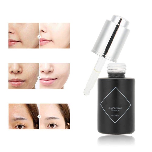  Sonew Skin Repair Essence Brightening Moisturizing Oligopeptide Serum Fade Spot Marks Repair Face Solution Anti-aging Lifting Serum 30ml