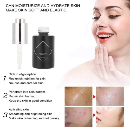  Sonew Skin Repair Essence Brightening Moisturizing Oligopeptide Serum Fade Spot Marks Repair Face Solution Anti-aging Lifting Serum 30ml