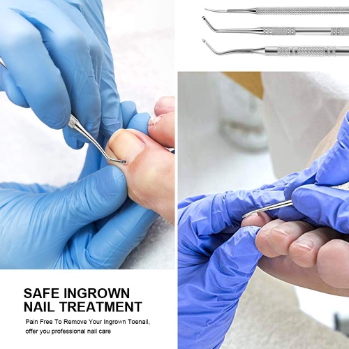  3pcs Ingrown Toenail File And Lifters, [ Upgraded ] Teenitor Professional Surgical Safe Nail Treatment Pedicure Tool Kit Under Nail Cleaner Tools Pain Relief