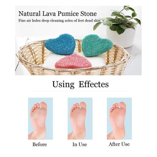  WeNeedU Pumice Stone for Feet,Natural Lava Pedicure Tools Hard Skin Premium Callus Remover for Feet and Hands,Natural Foot File Exfoliation to Remove Dead Skin,Natural Foot Scrubbe