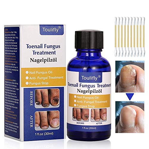  Cherioll Nail Repair, Natural Nail Treatment, Maximum Strength Nail Solution, Maximum Strength Fungal Toenail Solution