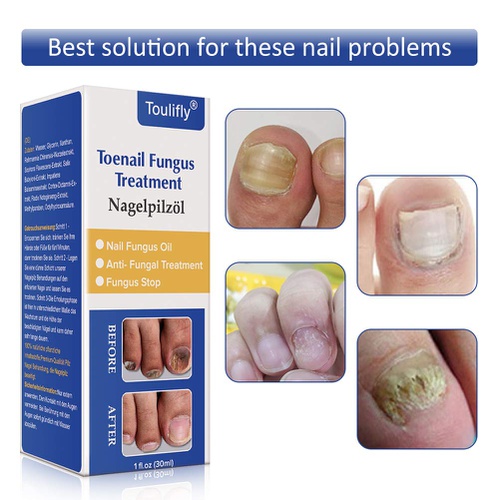  Cherioll Nail Repair, Natural Nail Treatment, Maximum Strength Nail Solution, Maximum Strength Fungal Toenail Solution