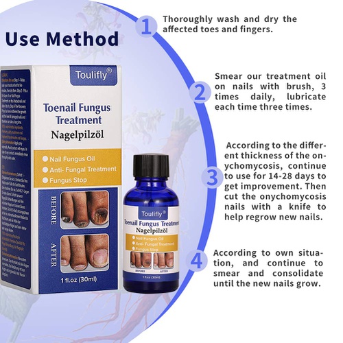  Cherioll Nail Repair, Natural Nail Treatment, Maximum Strength Nail Solution, Maximum Strength Fungal Toenail Solution