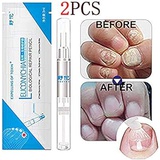 DTDR Euconychia Herbal Nail Treatment Pen Nail Repair Fingernails Toenails Rich Nutrition（2pcs)