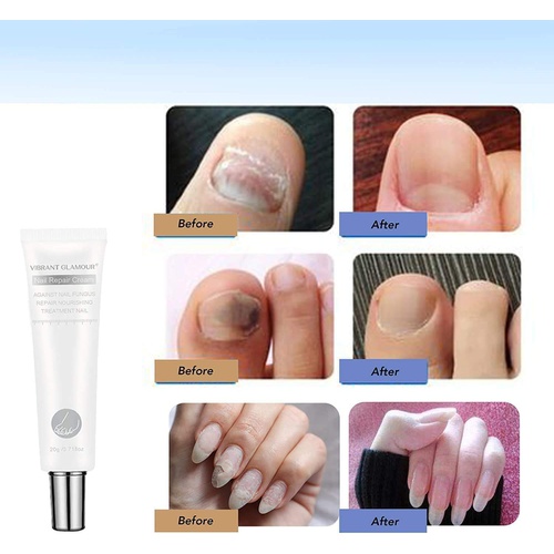  FUGJAOJO 1Pcs Vibrant Glamour Nail Care Nail Repair Cream Nail Fungus Treatment Onychomycosis Nail CareNail Repair Cream Nail Moisturizing, Restore Beautiful Nails