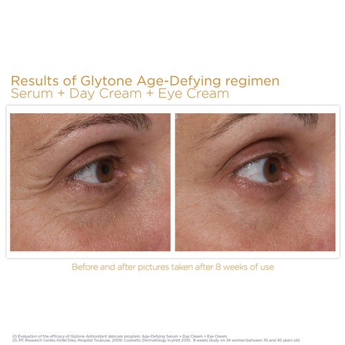  Glytone Age- Defying Antioxidant Eye Cream, 0.5 fl. oz