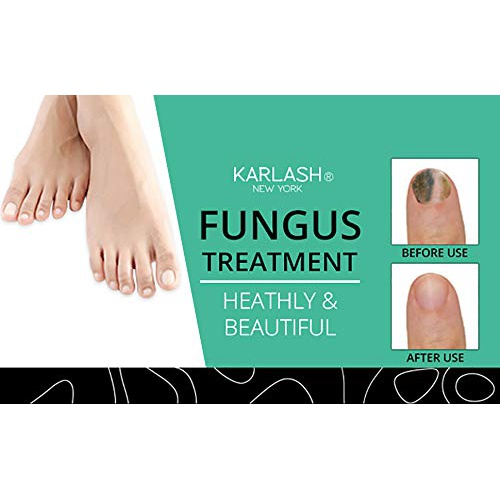  Karlash Finger & Toenail Fungus Treatment Kit EXTRA STRONG Made in USA Nail Fungus Care Nails Toe Nail 0.5 oz (Pack of 2)