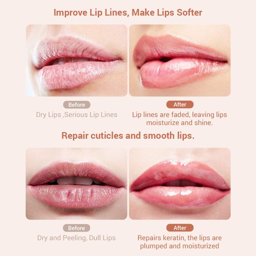  LANBENA Rose Lip Mask Overnight Vegan Lip Balm,Natural Extracts Collagen Lip Mask Skin Care Day and Night Moisturizing Repairing Lips Treatment Mask for Cracked Lips, Dry Lips, Wri