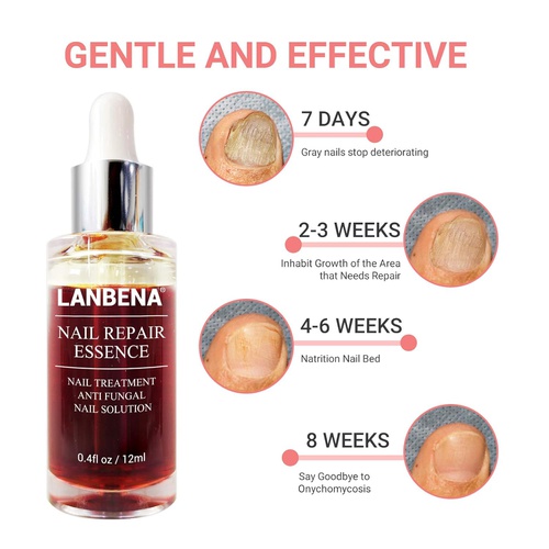  LANBENA Nail Repair Essence, Nails Repair Essence Nail Repair for Damaged Nails Protect Nail from Damage Fingernail and Toenail Repair for Curing Nail from Infection Discolored & D