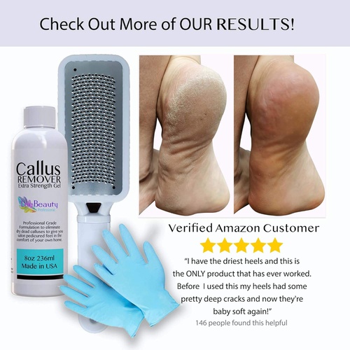  Lee Beauty Professional 8oz Callus Remover Gel and Foot File/Foot Rasp Spa Kit. Professional Foot Care for dry, cracked heels. Soak in foot spa then apply callus gel to feet, and use foot scraper to peel