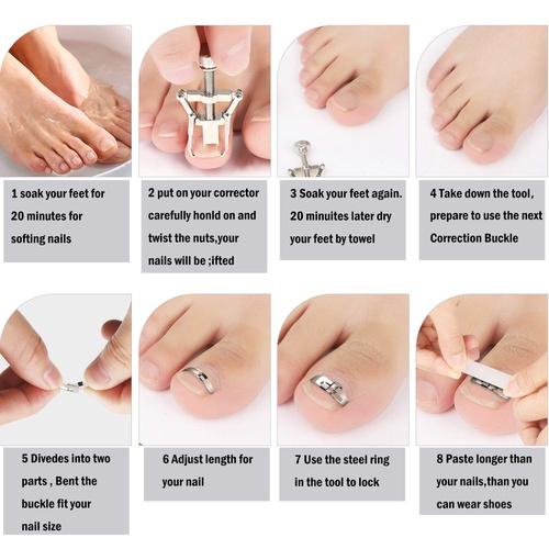  Mudder Ingrown Toenail Tools Kit, Includes Ingrown Toenail Lifter, Toe Nail Correction Buckle, 4 Sheets Ingrown Toenail Correction Patches for Ingrown Toe Nails Foot Care Tools