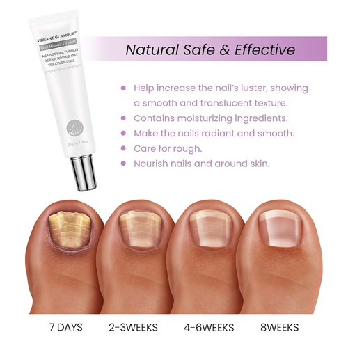  NEOMEN Toenail Fungus Treatment Cream, Nail Fungus Stop, Fungi Nail Fungus Remover, Maximum Strength Antifungal Cream