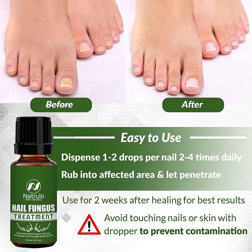  Natrulo Nail & Toenail Fungus Treatment -Natural Anti Fungal Nail Balm with Tea Tree Oil - 100% Pure Liquid HomeopathicInfection Fighter Remedy - Destroys Fungus & Restores Clear Healthy