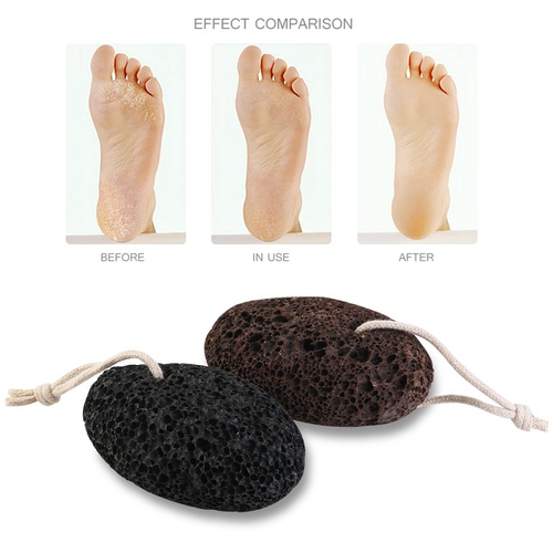  PIXNOR Pumice Stone Foot Scrubber Callus Remover Pack of 2