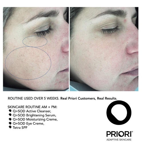  Priori Skincare Eye Creme with CoQ10 Lactic Acid Retinol Caffeine SOD Age Defying Eye Cream Corrective Hydrating Rejuvenating Eye Treatment 0.5 fl oz