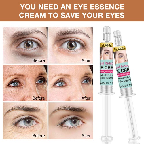  QILEBI 2Pack Rapid Reduction Eye Cream, Quick Repair Eye Cream, Eye Bags Treatment - Instant Results within 120 Seconds - Reduces Appearance of Dark Circles and Wrinkles and Fine Lines an