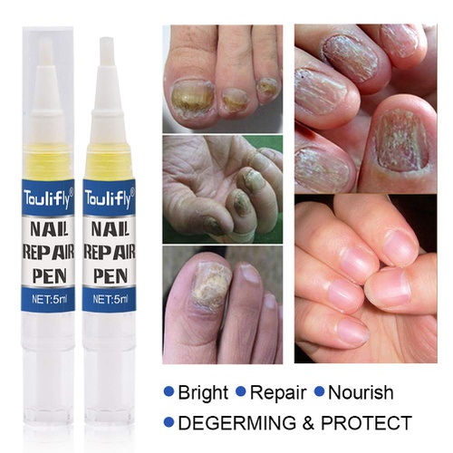  TOULIFLY Nail Repair, Nail Repair Pen, Nail Solution, Natural Nail Treatment, Effective Against Nail Infection Restores Discolored & Damaged Nails 4pc