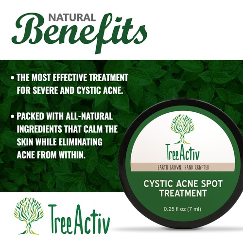  TreeActiv Cystic Acne Spot Treatment, Hormonal Acne Cream, Pimple Cream for Face, Back, and Body, 0.25 fl oz (7 ml)