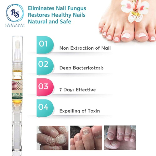  Tronos Nail Fungus Treatment - Effective Nail Solution for Fungal Infection on Toenails and Fingernails 2PC