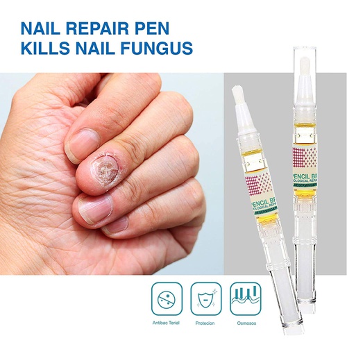  Tronos Nail Fungus Treatment - Effective Nail Solution for Fungal Infection on Toenails and Fingernails 2PC