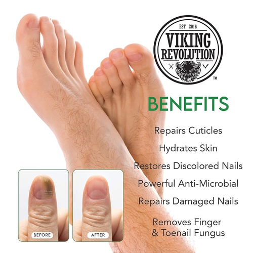  Viking Revolution Toenail Fungus Treatment Extra Strength - Antifungal Nail Treatment for Athletes Foot, Toe and Finger Nail Fungus Treatment