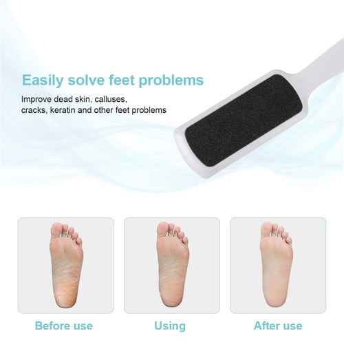  Yeipis Pedicure Foot Rasp File Callus Remover, Double-Sided Colossal Foot Rasp Foot File And Callus Remover For Dead Skin (Pack of 3)